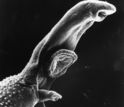 A parasitic worm that causes schistosomiasis